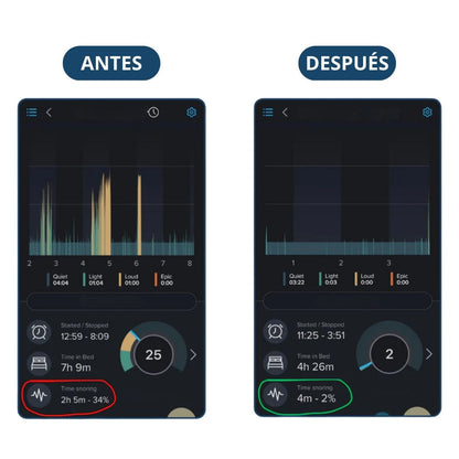 Znorex® Protector Bucal Anti-Ronquidos